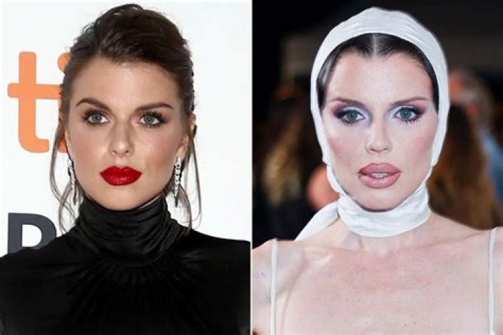 Julia Fox Before Nose Job: It Looks Different Now!